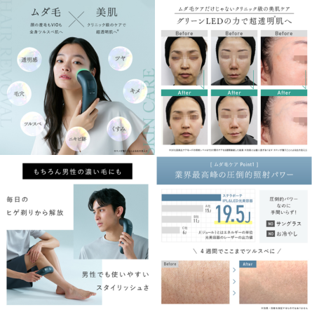 Kirala STELLA BEAUTE IPL&LED光美容器 - ベストアイテム Kirala STELLA BEAUTE IPLLED光美容器