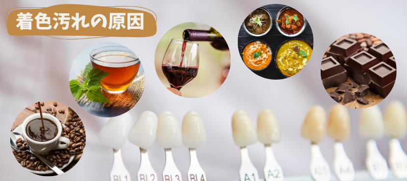 歯の着色汚れの原因とは - ベストアイテム 歯の着色汚れの原因とは